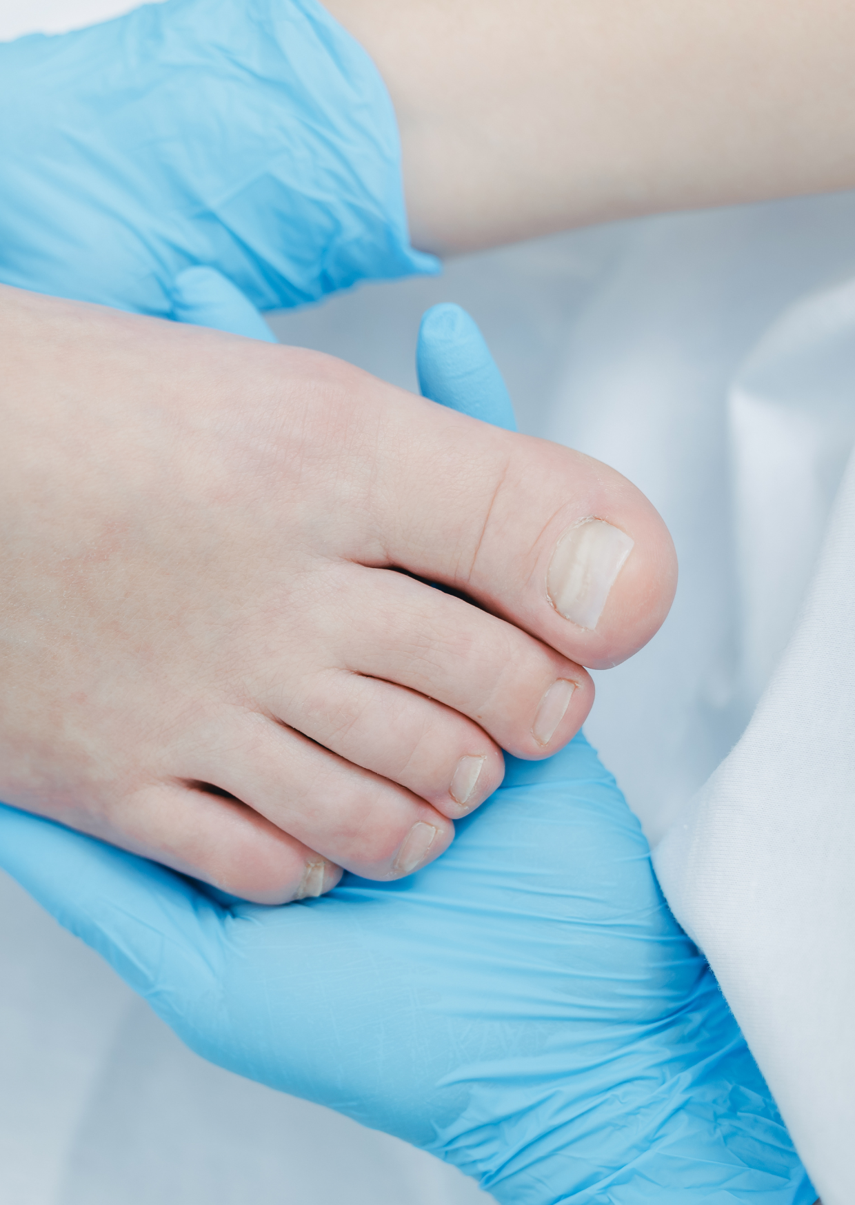Close-up of foot examined by medical professional wearing blue gloves, podiatrist treatment