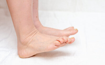 Does ToeFX Cure Fungal Toenails?